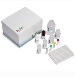 Inbios Receives Fda Clearance For Its Denv Detect Ns Elisa Test For